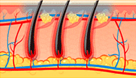 Basic principle : Hair structure